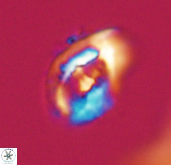 Helicosphaerella wilcoxonii VR 32365
