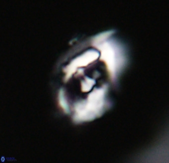 Helicosphaerella wilcoxonii VR 32366