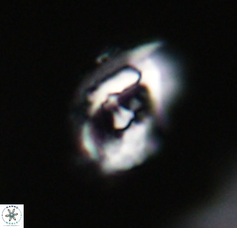 Helicosphaerella wilcoxonii VR 32366