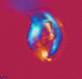 Helicosphaerella wilcoxonii VR 32368
