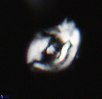 Helicosphaerella wilcoxonii VR 32371