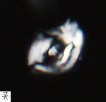 Helicosphaerella wilcoxonii VR 32371