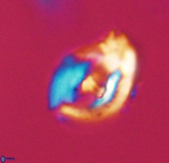 Helicosphaerella wilcoxonii VR 32372