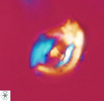 Helicosphaerella wilcoxonii VR 32372