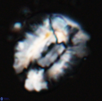 Helicosphaeroides lophotes 25864