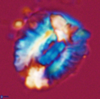 Helicosphaeroides lophotes 25865