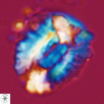 Helicosphaeroides lophotes 25865