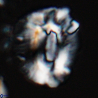 Helicosphaeroides lophotes 25866