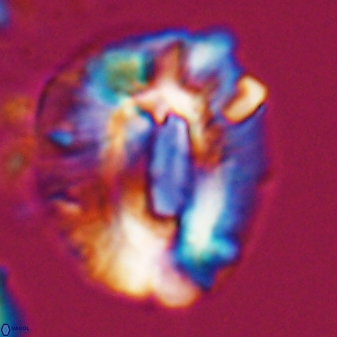 Helicosphaeroides lophotes 25867