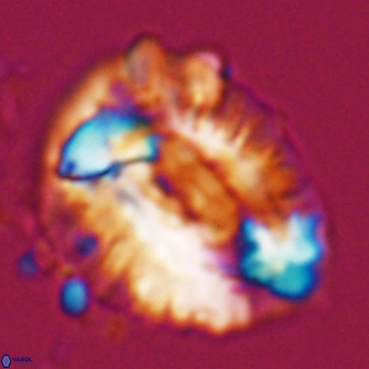 Helicosphaeroides lophotes 25868