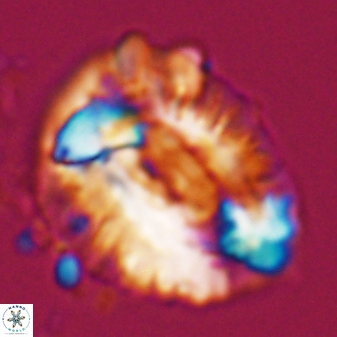 Helicosphaeroides lophotes 25868