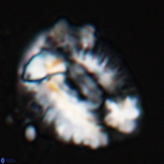 Helicosphaeroides lophotes 25869