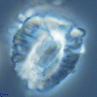 Helicosphaeroides lophotes 25871