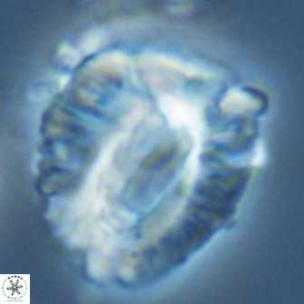 Helicosphaeroides lophotes 25871