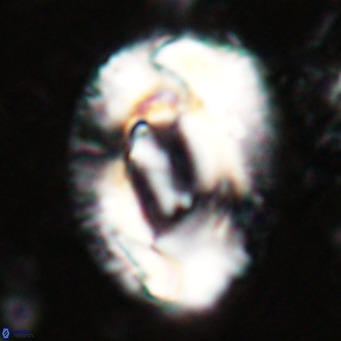 Helicosphaeroides lophotes VR 025213