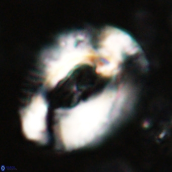 Helicosphaeroides lophotes VR 025214