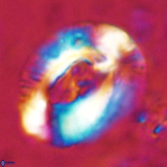 Helicosphaeroides lophotes VR 025215