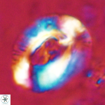 Helicosphaeroides lophotes VR 025215