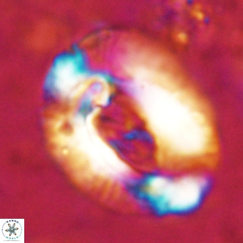 Helicosphaeroides lophotes VR 025217