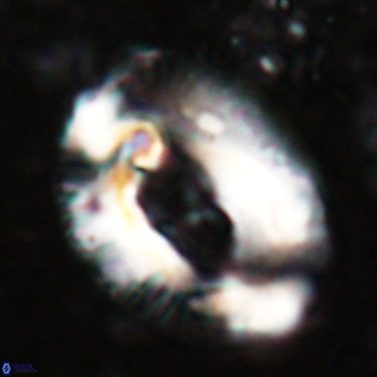 Helicosphaeroides lophotes VR 025218