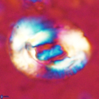 Helicosphaeroides lophotes VR 025220