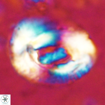 Helicosphaeroides lophotes VR 025220