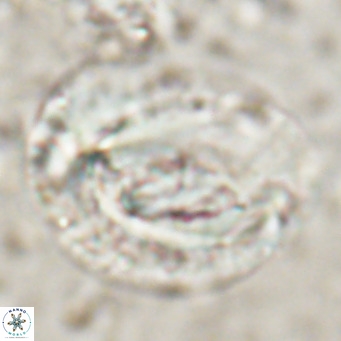 Helicosphaeroides lophotes VR 025221