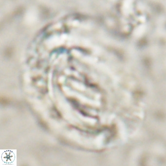 Helicosphaeroides lophotes VR 025222