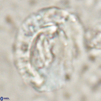 Helicosphaeroides lophotes VR 025223