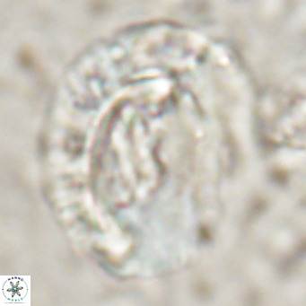 Helicosphaeroides lophotes VR 025223