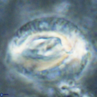 Helicosphaeroides lophotes VR 025226