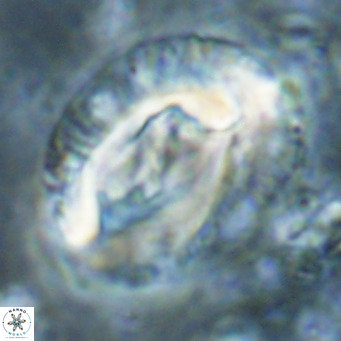 Helicosphaeroides lophotes VR 025227