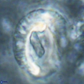 Helicosphaeroides lophotes VR 025229