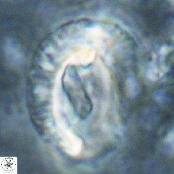 Helicosphaeroides lophotes VR 025229