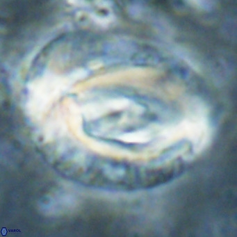 Helicosphaeroides lophotes VR 025231