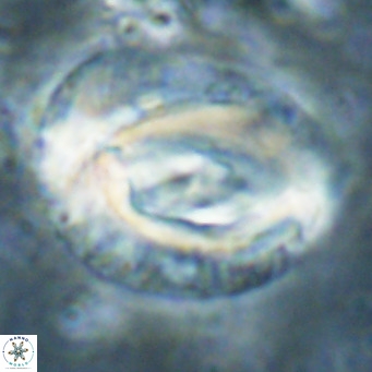 Helicosphaeroides lophotes VR 025231