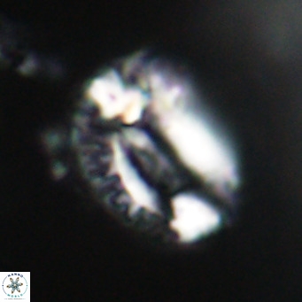 Helicosphaeroides lophotes VR 31180