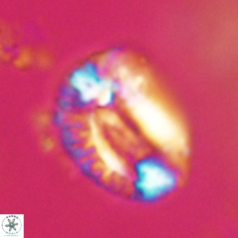 Helicosphaeroides lophotes VR 31181