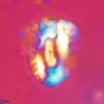 Helicosphaeroides lophotes VR 31182