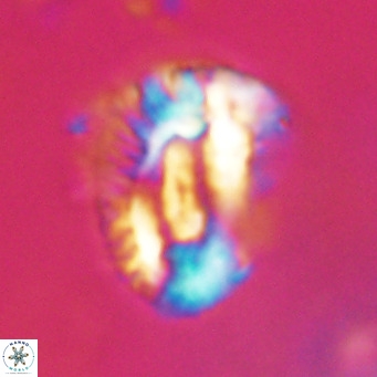 Helicosphaeroides lophotes VR 31182