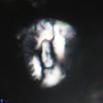 Helicosphaeroides lophotes VR 31183