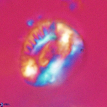 Helicosphaeroides lophotes VR 31185