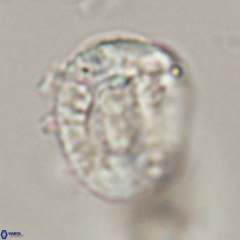Helicosphaeroides lophotes VR 31186