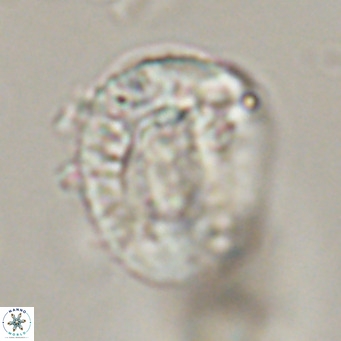 Helicosphaeroides lophotes VR 31186