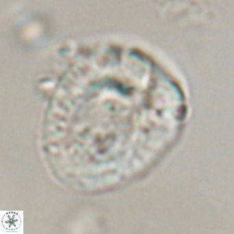 Helicosphaeroides lophotes VR 31187