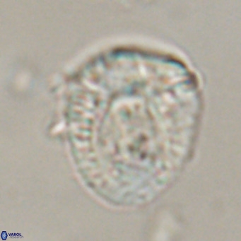 Helicosphaeroides lophotes VR 31188