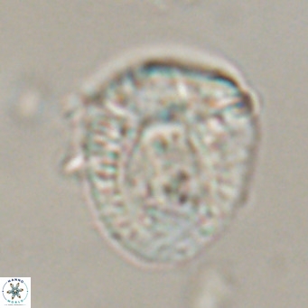 Helicosphaeroides lophotes VR 31188