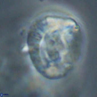 Helicosphaeroides lophotes VR 31189
