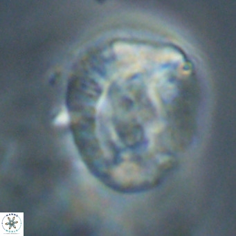 Helicosphaeroides lophotes VR 31189