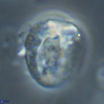 Helicosphaeroides lophotes VR 31190